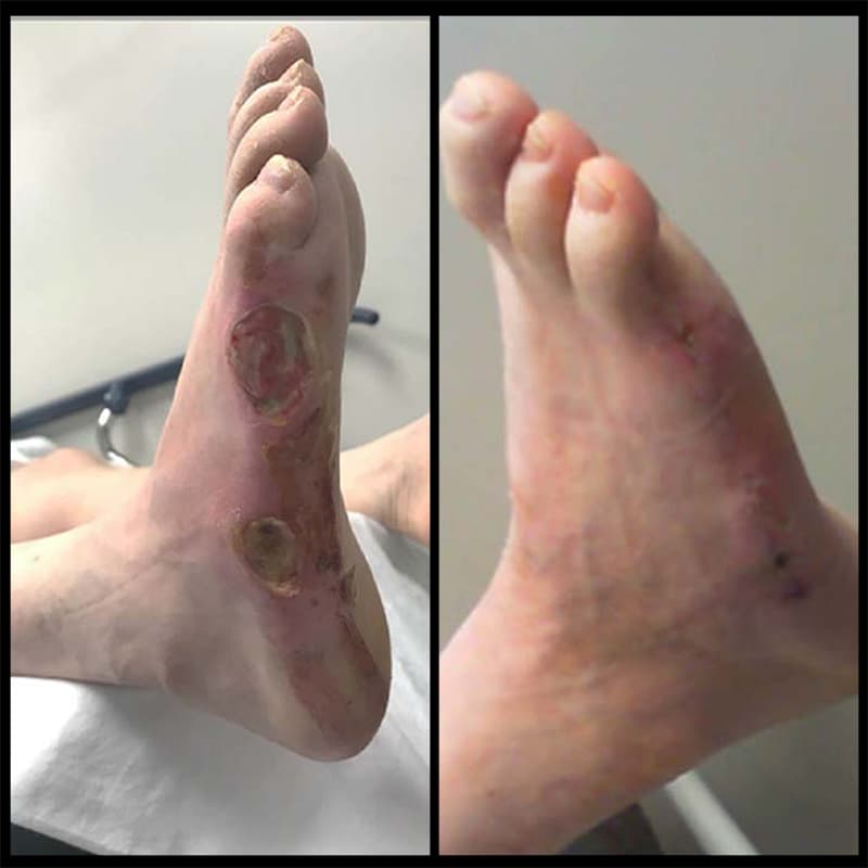 Buffalo Vascular Care patient result 1