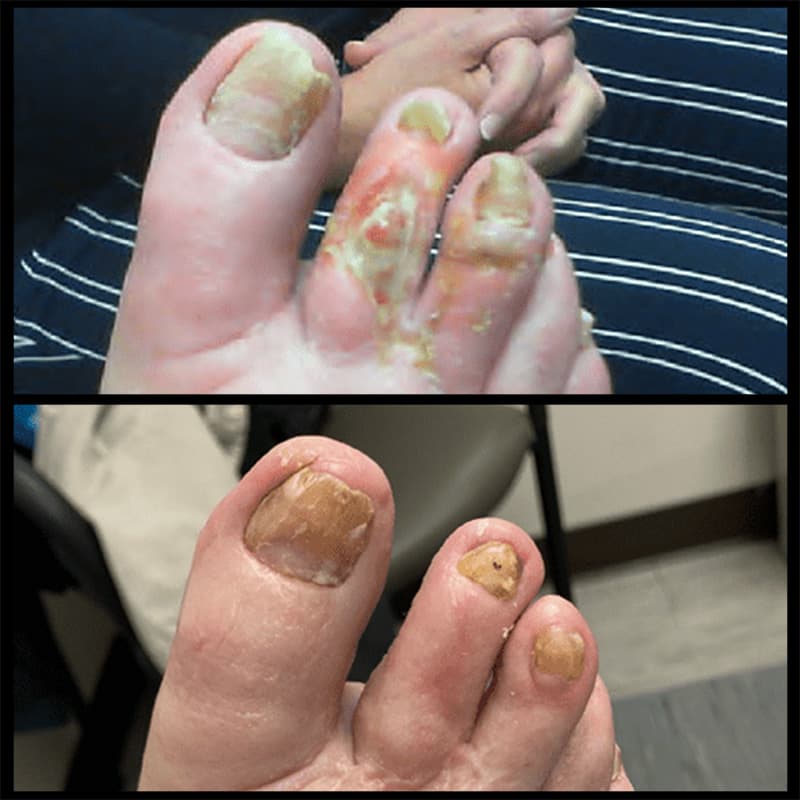 Buffalo Vascular Care patient result 5