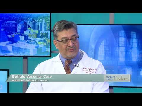 Dr. Azher Iqbal featured on WNY Living — Uterine Fibroid Embolization